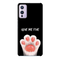 Give me five Printed Slim Cases and Cover for OnePlus 9